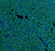 Immunofluorescent staining of FFPE human tonsil tissue with CD45 antibody (green) and DAPI nuclear stain (blue). HIER: Boil the paraffin sections in pH8 EDTA buffer for 20 minutes and allow to cool prior to staining.