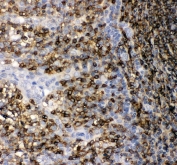 IHC staining of FFPE human tonsil tissue with CD45 antibody. HIER: Boil the paraffin sections in pH8 EDTA buffer for 20 minutes and allow to cool prior to staining.