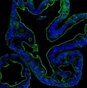 Villin Antibody for IF. Immunofluorescence analysis of Villin-1 (VIL1) in FFPE human colon using a VIL1 Immunofluorescence Antibody (rabbit polyclonal). Villin Antibody for IF shows strong, continuous apical membrane staining of colonic epithelial cells (green), clearly outlining the luminal brush border and emphasizing epithelial polarity, while nuclei are counterstained with DAPI (blue). The sharp, linear fluorescence along the glandular lumen highlights microvillus-rich absorptive surfaces, supporting use of this antibody for high-resolution immunofluorescence imaging of epithelial architecture and brush border cytoskeletal organization.