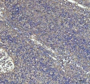 G-CSF Antibody Splenic Immune IHC. Immunohistochemistry of Granulocyte colony stimulating factor / CSF3 in FFPE human spleen tissue using G-CSF antibody. HRP-DAB brown staining highlights scattered cytoplasmic labeling in immune cell populations within splenic tissue, with a diffuse distribution consistent with cytokine expression in lymphoid compartments, while surrounding cells show low background staining and nuclei are counterstained blue. Heat induced epitope retrieval was performed by boiling tissue sections in pH 8 EDTA for 20 min followed by cooling prior to staining.