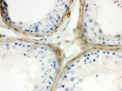 CLU Antibody Human Testis IHC. Immunohistochemistry testing of FFPE human testis with CLU antibody. HIER: Boil the paraffin sections in pH 6, 10mM citrate buffer for 20 minutes and allow to cool prior to staining.