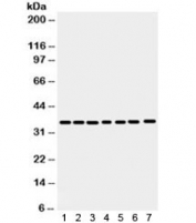 Western blot testing of 1) rat spleen, 2) rat stomach, 3) human HeLa, 4) 22RV1, 5) A549, 6) MCF7 and 7) SW620 antibody with Annexin A3 antibody. Predicted/observed molecular weight ~36 kDa.