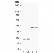 BMP2 Antibody Multi-Species WB. Western blot analysis of 1) rat brain, 2) rat lung, 3) human U87, and 4) human HeLa lysates using BMP2 Antibody / Osteogenic Growth Factor Antibody demonstrates immunoreactive bands corresponding to multiple molecular forms of Bone Morphogenetic Protein 2 (BMP2). Bands are observed at approximately 22 kDa in rat brain and lung lysates and at approximately 44 kDa in human U87 and HeLa cell lysates. BMP2 is synthesized as a larger precursor protein that undergoes proteolytic processing and can exist in monomeric, dimeric, and precursor-associated forms, contributing to variability in apparent molecular weight. BMP2 functions as a member of the TGF-beta superfamily and plays critical roles in osteogenesis, skeletal development, tissue regeneration, and morphogenetic signaling. The observed immunoreactive species are consistent with the known post-translational processing and maturation of BMP2.