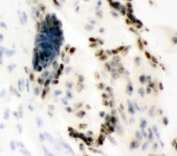 Ku80 Antibody Frozen Placenta IHC. Immunohistochemistry testing of frozen human placenta with Ku80 antibody. 