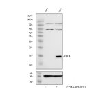 MIP1 Beta Antibody by WB in untreated and stimulated THP-1 cells. Western blot analysis of untreated and PMA/LPS/brefeldin A-stimulated human THP-1 cell lysates using MIP1 Beta Antibody. An immunoreactive band near 15 kDa is prominent in the stimulated sample and weak or undetectable in the untreated sample, consistent with increased CCL4-associated signal following inflammatory stimulation. Additional higher-molecular-weight immunoreactivity is present in both samples. This CCL4 Polyclonal Antibody targets a chemokine involved in macrophage activation and inflammatory signaling.