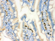 FABP4 Antibody Rat Intestine IHC. Immunohistochemistry testing of FFPE rat intestine with FABP4 antibody. HIER: Boil the paraffin sections in pH 6, 10mM citrate buffer for 20 minutes and allow to cool prior to staining.