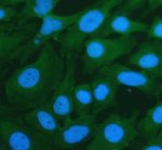 CD46 Antibody HeLa Cell IF. Immunofluorescent staining of HeLa cells demonstrates CD46 expression after enzyme-mediated antigen retrieval and labeling with a Fluoro488-conjugated secondary antibody (green), while nuclei are counterstained with DAPI (blue). Fluorescence is observed predominantly along the plasma membrane with additional cytoplasmic staining, consistent with the localization of membrane cofactor protein as a cell surface complement regulatory glycoprotein. This CD46 Antibody, also called Membrane Cofactor Protein Antibody, is suitable for immunofluorescence studies of complement regulation, immune cell biology, and host-pathogen interactions.