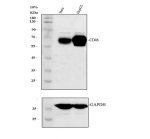 CD46 Antibody Human Cancer Cell WB. Western blot demonstrates detection of CD46 in human HeLa and HepG2 cell lysates. A broad immunoreactive band is observed between approximately 50-70 kDa, higher than the predicted molecular weight of 44 kDa due to extensive glycosylation of membrane cofactor protein. The strong signal in both cancer cell lines is consistent with the widespread expression of CD46 on human nucleated cells and its role as a complement regulatory glycoprotein. GAPDH serves as the loading control. This CD46 Antibody, also called Membrane Cofactor Protein Antibody, is suitable for studies of complement regulation, immune cell biology, and host-pathogen interactions.