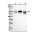 CD46 Antibody Human Cancer and Keratinocyte WB. Western blot demonstrates detection of CD46 in human A549 lung carcinoma, RT4 bladder carcinoma, and HaCaT keratinocyte cell lysates. A broad immunoreactive band is observed between approximately 50-70 kDa, higher than the predicted molecular weight of 44 kDa due to extensive N-linked and O-linked glycosylation of membrane cofactor protein. Variable electrophoretic mobility among the cell lines is consistent with differences in CD46 glycosylation and isoform expression. This CD46 Antibody, also called Membrane Cofactor Protein Antibody, is suitable for studies of complement regulation, immune responses, and cell surface glycoprotein expression.