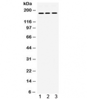 PDGFR Alpha Antibody Multi-Species WB. Western blot analysis of rat brain (lane 1), human HeLa (lane 2), and mouse NIH3T3 (lane 3) lysates using PDGFR Alpha Antibody / Receptor Tyrosine Kinase Antibody demonstrates strong immunoreactive bands at approximately 180 kDa. PDGFRA is a cell-surface receptor tyrosine kinase that mediates platelet-derived growth factor signaling and regulates cellular proliferation, migration, differentiation, and survival. The observed molecular weight is consistent with mature glycosylated PDGFRA, which commonly migrates at substantially higher apparent molecular weights than its predicted core protein size due to extensive post-translational glycosylation. Detection of comparable bands across rat, human, and mouse samples supports conserved expression of PDGFRA among multiple species. Expected and observed molecular weight: 120-195 kDa, depending on glycosylation level.
