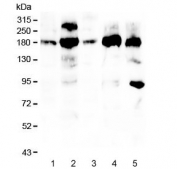 PDGFR Alpha Antibody Cancer Cell Panel WB. Western blot analysis of human HT1080 (lane 1), Caco-2 (lane 2), U-2 OS (lane 3), PC-3 (lane 4), and 293T (lane 5) cell lysates using PDGFR Alpha Antibody / Receptor Tyrosine Kinase Antibody demonstrates immunoreactive bands predominantly within the 180-195 kDa range, consistent with expression of glycosylated PDGFRA. Variation in apparent molecular weight and band intensity among cell lines is expected due to differences in receptor glycosylation, maturation state, and expression level. PDGFRA is a receptor tyrosine kinase that mediates platelet-derived growth factor signaling and regulates cellular proliferation, migration, differentiation, and survival. The observed banding patterns support endogenous PDGFRA expression across multiple human cancer-derived and immortalized cell lines. Expected and observed molecular weight: 120-195 kDa, depending on glycosylation level.