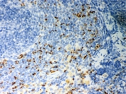 CD36 Antibody Rat Spleen IHC. Immunohistochemical staining of FFPE rat spleen demonstrates CD36 expression using a CD36 antibody. CD36, also known as Fatty Acid Translocase, is a multifunctional scavenger receptor involved in long chain fatty acid uptake, lipid metabolism, and immune regulation. Predominantly membranous and cytoplasmic staining is observed in splenic macrophages and other mononuclear cells, consistent with the established role of CD36 in phagocytosis, inflammation, and recognition of oxidized lipoproteins. Heat induced epitope retrieval was performed by boiling tissue sections in pH 6 10 mM citrate buffer for 20 minutes followed by cooling prior to staining. These results support the utility of CD36 Antibody for studies of scavenger receptor biology, lipid transport, immune responses, and metabolic disease.