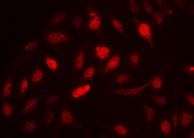 Immunofluorescence analysis of Cyclin A2 antibody in FFPE human U-2 OS cells. Cells demonstrate strong nuclear fluorescence signal consistent with Cyclin A2 localization in proliferating cells, with minimal cytoplasmic staining. The distribution pattern aligns with the known role of Cyclin A2 as a nuclear cell cycle regulator expressed during S phase and G2 phase. Heat-induced epitope retrieval was performed by steaming sections in pH 6 citrate buffer for 20 minutes prior to staining.