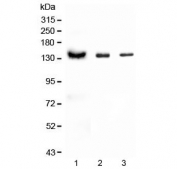 CD22 Antibody for WB. Western blot analysis of CD22/Siglec-2 expression using CD22 Western Blot Antibody in multiple species. Lane 1: human Raji lysate, Lane 2: rat thymus lysate, Lane 3: mouse thymus lysate. A band is detected at approximately 130-150 kDa, consistent with the predicted molecular weight of CD22 / CD22 and reflecting its glycosylated form, while lower molecular weight species may correspond to less modified or partially processed forms of the protein. The presence of signal across human, rat, and mouse samples aligns with the known expression of CD22 in B cell populations and supports its use for cross-species analysis of B cell-associated protein expression.