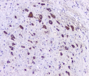 5HT2AR Antibody Rat Brain IHC. Immunohistochemical staining of FFPE rat brain tissue using 5HT2AR Antibody at 1 ug/ml. HIER was performed in pH 6 citrate buffer. An HRP-conjugated secondary antibody with DAB substrate was used for detection. 5HT2AR Antibody, a Serotonin Receptor Antibody, demonstrates strong cytoplasmic staining of neurons with minimal staining of the surrounding neuropil, consistent with the expected neuronal expression pattern of HTR2A.