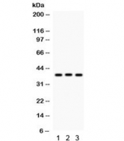 CTGF Antibody WB. Western blot analysis of 1) rat liver, 2) rat thymus, and 3) human HeLa cell lysates using CTGF Antibody / Extracellular Matrix Remodeling Antibody demonstrates a distinct immunoreactive band at approximately 38 kDa in all samples tested. The observed molecular weight is consistent with the predicted size of Connective Tissue Growth Factor (CTGF), also known as Cellular Communication Network Factor 2 (CCN2), a secreted matricellular protein involved in extracellular matrix regulation, tissue remodeling, and cellular signaling. Consistent detection across rodent and human samples supports recognition of a conserved CTGF epitope and demonstrates broad species reactivity. The observed immunoreactivity highlights the utility of this antibody for studies of fibrosis, connective tissue biology, extracellular matrix remodeling, wound healing, and tumor microenvironment signaling.