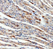 IHC staining of FFPE mouse heart tissue with SDHA antibody. HIER: boil tissue sections in pH8 EDTA for 20 min and allow to cool before testing.