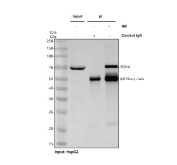 Immunoprecipitation of SDHA protein from 500ug of human HepG2 whole cell lysate with 2ug of SDHA antibody.