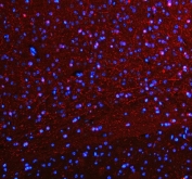 SERT Antibody Mouse Brain IF. Immunofluorescent staining of FFPE mouse brain tissue using SERT Antibody / Serotonin Reuptake Transporter Antibody demonstrates widespread red fluorescence associated with neural processes and neuropil-rich regions throughout the tissue. The staining pattern is consistent with expression of the Serotonin Transporter (SERT/SLC6A4), a membrane-associated protein responsible for serotonin reuptake and regulation of serotonergic neurotransmission. The extensive fibrillar and punctate signal observed within the brain parenchyma is consistent with localization of SERT to serotonergic neuronal projections and synaptic regions involved in neurotransmitter recycling and signal termination. Nuclei are counterstained with DAPI (blue). HIER: steam section in pH 8 EDTA buffer for 20 minutes prior to staining.