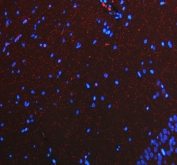 SERT Antibody Rat Brain IF. Immunofluorescent staining of FFPE rat brain tissue using SERT Antibody / Serotonin Reuptake Transporter Antibody demonstrates diffuse red fluorescence distributed throughout neuropil-rich regions and neuronal process networks. The staining pattern is consistent with expression of the Serotonin Transporter (SERT/SLC6A4), a membrane-associated transporter responsible for reuptake of serotonin from synaptic spaces and maintenance of serotonergic neurotransmission. The fine fibrillar signal observed throughout the tissue is characteristic of serotonergic axons and neuronal projections, reflecting the widespread distribution of serotonin signaling pathways within the central nervous system. Nuclei are counterstained with DAPI (blue). HIER: steam section in pH 8 EDTA buffer for 20 minutes prior to staining.