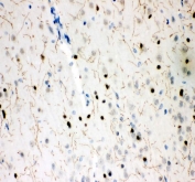 SERT Antibody Rat Brain IHC. Immunohistochemistry staining of FFPE rat brain tissue using SERT Antibody / Serotonin Reuptake Transporter Antibody demonstrates fine neuritic and neuropil-associated HRP-DAB brown staining throughout the brain parenchyma, accompanied by scattered neuronal cell body immunoreactivity. The staining pattern is consistent with expression of the Serotonin Transporter (SERT/SLC6A4), a membrane-associated transporter responsible for serotonin reuptake and maintenance of serotonergic neurotransmission. The extensive network of delicate fiber-like processes highlighted by the antibody is characteristic of serotonergic projections and synaptic regions where SERT regulates extracellular serotonin levels and neurotransmitter recycling. HIER: boil tissue sections in pH 8 EDTA buffer for 20 minutes and allow to cool before testing.