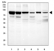 Western blot testing of 1) human HEL, 2) human A549, 3) rat lung, 4) rat heart, 5) mouse lung and 6) mouse heart tissue lysate with STAT3 antibody. Expected molecular weight: ~92 kDa (alpha) and ~83 kDa (beta).