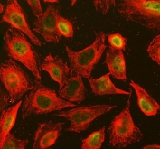 Immunofluorescent staining of FFPE human U-2 OS cells with STAT3 antibody (green) and Beta Tubulin mAb (red). HIER: steam section in pH6 citrate buffer for 20 min.
