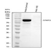 Immunoprecipitation of STAT3 protein from 500ug of human HeLa whole cell lysate with 2ug of STAT3 antibody.