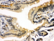 STAT1 Antibody Mouse Intestine IHC. Immunohistochemistry staining of FFPE mouse intestine tissue using STAT1 antibody demonstrates prominent staining within intestinal epithelial cell populations, consistent with expression of Signal Transducer and Activator of Transcription 1 (STAT1). STAT1 is a central transcription factor within the JAK-STAT signaling pathway that mediates cellular responses to interferons, cytokines, and other extracellular signaling molecules. The observed staining pattern is consistent with the role of STAT1 in regulating immune signaling, epithelial homeostasis, and transcriptional responses to environmental and inflammatory stimuli within gastrointestinal tissues. These findings support the utility of STAT1 antibody for studies of signal transduction, cytokine-responsive pathways, and tissue-specific transcription factor expression. HIER: boil paraffin sections in pH 6 10mM citrate buffer for 20 minutes and allow to cool prior to staining.