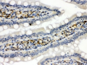 STAT1 Antibody Rat Intestine IHC. Immunohistochemistry staining of FFPE rat intestine tissue using STAT1 antibody demonstrates distinct staining within intestinal epithelial and mucosal-associated cell populations, consistent with expression of Signal Transducer and Activator of Transcription 1 (STAT1). STAT1 is a key transcription factor within the JAK-STAT signaling pathway that mediates cellular responses to interferons, cytokines, and immune regulatory signals. The observed staining pattern is consistent with the role of STAT1 in regulating transcriptional programs involved in epithelial homeostasis, immune surveillance, and cytokine-responsive signaling within gastrointestinal tissues. These findings support the utility of STAT1 antibody for studies of signal transduction, immune regulation, and tissue-specific gene expression. HIER: boil paraffin sections in pH 6 10mM citrate buffer for 20 minutes and allow to cool prior to staining.