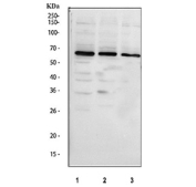 Western blot testing of 1) human 293T, 2) human HeLa and 3) human K562 cell lysate with GRK6 antibody. Expected molecular weight ~66 kDa.