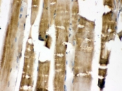 MKK3 Antibody / p38 MAP Kinase Kinase Antibody Rat Skeletal Muscle IHC. Immunohistochemical staining of FFPE rat skeletal muscle tissue using MKK3 Antibody / p38 MAP Kinase Kinase Antibody. MKK3 expression is detected throughout skeletal muscle fibers, consistent with its role as a stress-responsive dual-specificity kinase that activates the p38 MAPK signaling pathway involved in muscle development, regeneration, and cellular adaptation to physiological stress. Heat-induced epitope retrieval was performed by boiling tissue sections in pH 6.0 citrate buffer for 20 minutes followed by cooling before staining. This staining pattern supports the use of the antibody for investigating p38 MAPK signaling in skeletal muscle biology and disease.