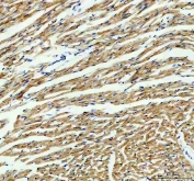 IHC staining of FFPE mouse heart tissue with IDH2 antibody. HIER: boil tissue sections in pH8 EDTA for 20 min and allow to cool before testing.
