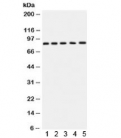 Western blot testing of 1) rat brain, 2) rat testis, 3) human SGC-7901, 4) 22RV1 and 5) MCF7 lysate with APLP1 antibody. Expected molecular weight: 76 kDa (unmodified), ~86 kDa (soluble/glycosylated form), 92~95 kDa (mature form).
