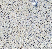 IHC staining of FFPE rat liver tissue with FOXA3 antibody. HIER: boil tissue sections in pH8 EDTA for 20 min and allow to cool before testing.
