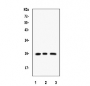 Western blot testing of 1) rat brain, 2) human Raji and 3) human SMMC lysate with RAB14 antibody. Expected/observed molecular weight ~24 kDa.