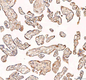 IHC staining of FFPE human placental tissue with RAB14 antibody, HRP-labeled secondary and DAB substrate. HIER: boil tissue sections in pH8 EDTA for 20 min and allow to cool before testing.