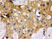 MUNC18-1 Antibody Rat Brain IHC. Immunohistochemical staining of FFPE rat brain tissue with MUNC18-1 antibody. Heat-induced epitope retrieval (HIER) was performed by boiling tissue sections in pH 6, 10 mM citrate buffer for 20 minutes and allowing them to cool prior to staining. Strong MUNC18-1 immunoreactivity is observed predominantly within the cytoplasm of neurons throughout the brain, with diffuse staining extending into the surrounding neuropil, consistent with the expected neuronal localization of STXBP1. Cell nuclei are counterstained with hematoxylin (blue).
