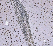 IHC staining of FFPE rat brain tissue with SNRPN antibody. HIER: boil tissue sections in pH8 EDTA for 20 min and allow to cool before testing.