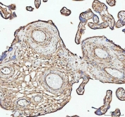 IHC staining of FFPE human placental tissue with anti-Actin antibody. HIER: boil tissue sections in pH8 EDTA for 20 min and allow to cool before testing.