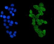 IKZF1 Antibody MCF-7 IF. Immunofluorescent staining of MCF-7 cells using IKZF1 Antibody / Ikaros Family Zinc Finger 1 Antibody demonstrates strong green fluorescence within the cellular compartment, consistent with expression of IKZF1 (Ikaros), a zinc finger transcription factor that regulates hematopoietic differentiation, lymphoid development, and gene expression programs involved in cellular fate determination. Positive immunoreactivity confirms detection of endogenous IKZF1 and supports the utility of this antibody for immunofluorescence applications. Nuclei are counterstained with DAPI (blue). Enzymatic antigen retrieval was performed for 15 min prior to staining, followed by incubation with IKZF1 antibody (5 ug/ml) overnight at 4Â°C and DyLight 488-conjugated secondary antibody detection.