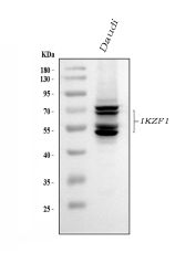 IKZF1 Antibody Daudi WB. Western blot analysis of human Daudi cell lysate using IKZF1 Antibody / Ikaros Family Zinc Finger 1 Antibody demonstrates multiple immunoreactive bands between approximately 50â70 kDa, consistent with the known molecular weight range of IKZF1 (Ikaros). IKZF1 undergoes extensive alternative splicing, generating multiple protein isoforms that differ in DNA-binding and regulatory domains, resulting in the characteristic multi-band pattern frequently observed in lymphoid cells. As a master regulator of hematopoietic and lymphoid differentiation, IKZF1 plays essential roles in immune cell development, transcriptional regulation, and chromatin remodeling. Detection of multiple endogenous IKZF1 isoforms in Daudi cells supports the specificity of this antibody for western blot applications. Predicted molecular weight: ~50â70 kDa. Observed molecular weights: ~50â70 kDa.