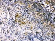 IRF5 Antibody Mouse Spleen IHC. Immunohistochemistry was performed on FFPE mouse spleen tissue using IRF5 Antibody. Heat-induced epitope retrieval was performed by boiling tissue sections in pH 6, 10 mM citrate buffer for 20 minutes followed by cooling prior to incubation with the primary antibody. Bound antibody was visualized using an HRP-conjugated secondary antibody and DAB chromogen. Distinct nuclear staining is observed within splenic immune cell populations, consistent with the role of IRF5 as an immune response-regulating transcription factor. These results demonstrate that this Immune Response Regulator Antibody is suitable for immunohistochemical detection of IRF5 in formalin-fixed, paraffin-embedded mouse spleen tissue.