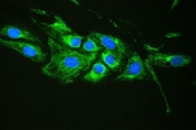 Plectin Antibody U-2 OS Cells IF. Immunofluorescent staining of human U-2 OS cells demonstrates plectin expression using a Plectin antibody (green). Plectin is a large cytolinker protein that organizes intermediate filaments, microtubules, and actin networks to maintain cellular architecture and mechanical stability. Extensive cytoplasmic filamentous staining is observed throughout the cells, consistent with the role of plectin in coordinating cytoskeletal organization and intracellular scaffolding. DAPI nuclear counterstain identifies cell nuclei (blue). Heat induced epitope retrieval was performed by boiling sections in pH 6 10 mM citrate buffer for 20 minutes followed by cooling prior to staining. These results support the utility of Plectin Antibody for studies of cytoskeletal organization, cell adhesion, mechanotransduction, and cancer biology.