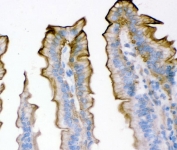 Plectin Antibody Mouse Intestine IHC. Immunohistochemical staining of FFPE mouse intestine demonstrates plectin expression using a Plectin antibody. Plectin is a major cytoskeletal linker protein that connects intermediate filaments to membrane adhesion complexes and contributes to epithelial integrity and resistance to mechanical stress. Prominent apical and lateral membranous staining is observed in intestinal epithelial cells lining the villi, highlighting the role of plectin in maintaining tissue architecture and cell polarity. Heat induced epitope retrieval was performed by boiling paraffin sections in pH 8 EDTA buffer for 20 minutes followed by cooling prior to staining. These results support the utility of Plectin Antibody for studies of epithelial biology, cytoskeletal organization, and tissue homeostasis.