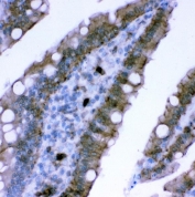 Plectin Antibody Rat Intestinal Epithelium IHC. Immunohistochemical staining of FFPE rat intestine demonstrates plectin expression using a Plectin antibody. Plectin is a versatile cytolinker protein that anchors intermediate filaments to membrane associated complexes and helps preserve epithelial architecture under conditions of mechanical stress. Distinct cytoplasmic and circumferential membranous staining is observed in absorptive epithelial cells lining the intestinal villi, consistent with the localization of plectin within junctional and cytoskeletal networks. Heat induced epitope retrieval was performed by boiling paraffin sections in pH 8 EDTA buffer for 20 minutes followed by cooling prior to staining. These results support the utility of Plectin Antibody for investigations of epithelial integrity, cytoskeletal organization, and tissue homeostasis.