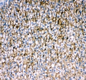 IHC staining of FFPE rat adrenal gland tissue with Srb1 antibody. HIER: boil tissue sections in pH8 EDTA for 20 min and allow to cool before testing.