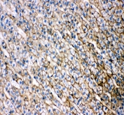SRB1 Antibody Rat Adrenal Cortex IHC. Immunohistochemical staining of FFPE rat adrenal gland showed strong membrane and cytoplasmic SRB1 expression throughout the adrenal cortex, with minimal staining in surrounding stromal regions. Heat-induced epitope retrieval was performed in pH8 EDTA buffer prior to staining with HRP-DAB detection. The staining pattern is consistent with the high expression of SCARB1 in steroidogenic cells that utilize HDL-derived cholesterol for steroid hormone synthesis. This SRB1 Antibody, an SCARB1 Antibody, is well suited for immunohistochemical studies of adrenal steroidogenesis, cholesterol transport and endocrine tissue biology.
