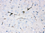 CP Antibody Mouse Brain IHC. Immunohistochemical staining of FFPE mouse brain tissue using CP antibody demonstrates distinct staining of ramified glial-like cells distributed throughout the neural parenchyma. The staining pattern is consistent with expression of Ceruloplasmin (CP), a multicopper ferroxidase involved in iron metabolism, copper transport, and maintenance of metal ion homeostasis within the central nervous system. In addition to its well-established role as a circulating plasma protein, Ceruloplasmin contributes to local regulation of iron handling and oxidative balance in neural tissues. The observed cellular staining supports the importance of CP in maintaining iron homeostasis and protecting against metal-associated oxidative stress within the brain. HIER: boil paraffin sections in pH 6, 10 mM citrate buffer for 20 minutes and allow to cool prior to staining.