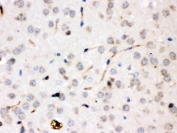 CP Antibody Rat Brain IHC. Immunohistochemical staining of FFPE rat brain tissue using CP antibody demonstrates selective staining of scattered neural parenchymal cells with delicate cellular processes extending through the surrounding tissue. The staining pattern is consistent with expression of Ceruloplasmin (CP), a multicopper ferroxidase that contributes to iron metabolism, copper transport, and maintenance of metal ion homeostasis within the central nervous system. In addition to its role as a major circulating plasma protein, Ceruloplasmin participates in local regulation of iron handling and redox balance in neural tissues, helping support normal cellular function and protection from metal-associated oxidative stress. The observed staining distribution is consistent with the established involvement of Ceruloplasmin in neural iron homeostasis. HIER: boil paraffin sections in pH 6, 10 mM citrate buffer for 20 minutes and allow to cool prior to staining.